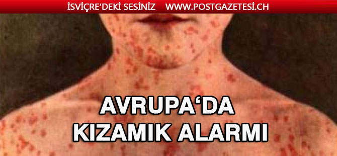 Avrupa'da kızamık alarmı