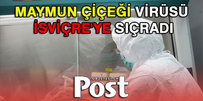 Korkulan oldu! Maymun çiçeği virüsü İsviçre'ye de sıçradı