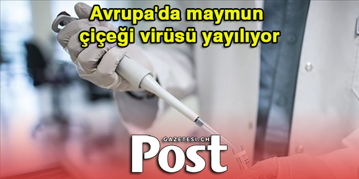 Avrupa'da maymun çiçeği virüsü yayılıyor