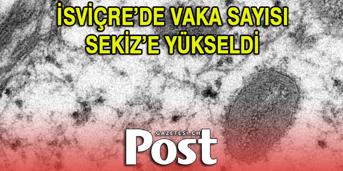 İSVİÇRE’DE MAYMUN ÇİÇEĞİ: VAKA SAYISI 8’E YÜKSELDİ