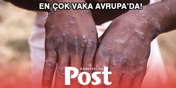 DSÖ: EN ÇOK VAKA AVRUPA'DA