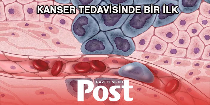 Kanser tedavisinde bir ilk: 6 ayda tüm hastalar iyileşti