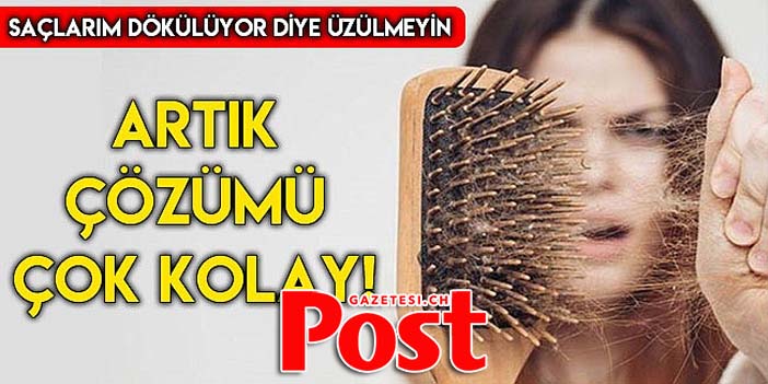 SAÇLARIM DÖKÜLÜYOR DİYE ÜZÜLMEYİN