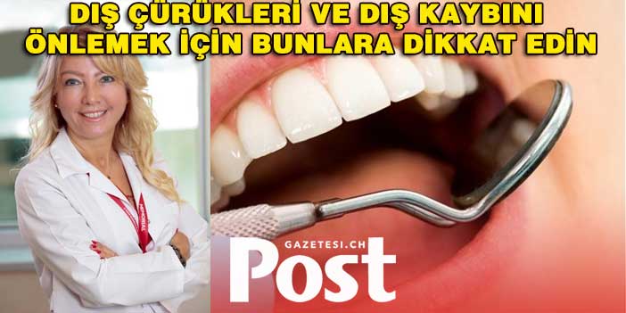 Diş çürükleri ve diş kaybını önlemek için bunlara dikkat edin