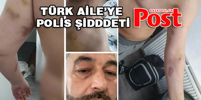 Türk ailenin yardım çığlığına polis şiddeti