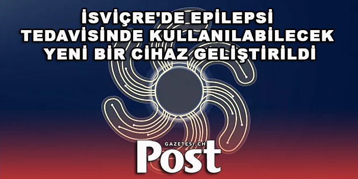 İsviçre'de epilepsi tedavisinde kullanılabilecek yeni bir cihaz geliştirildi