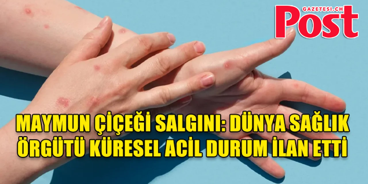 DSÖ ikinci kez küresel acil durum ilan etti! Virüs 13 ülkeye yayıldı