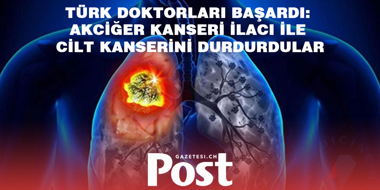 Türk doktorları başardı: Akciğer kanseri ilacı ile cilt kanserini durdurdular