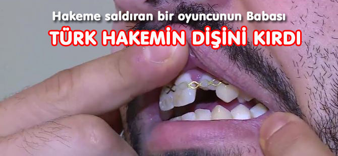 OYUNCU’NUN BABASI TÜRK HAKEMİN DİŞİNİ KIRDI