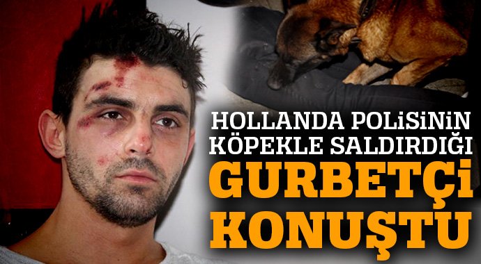 Hollanda polisinin köpekle saldırdığı vatandaşımız konuştu