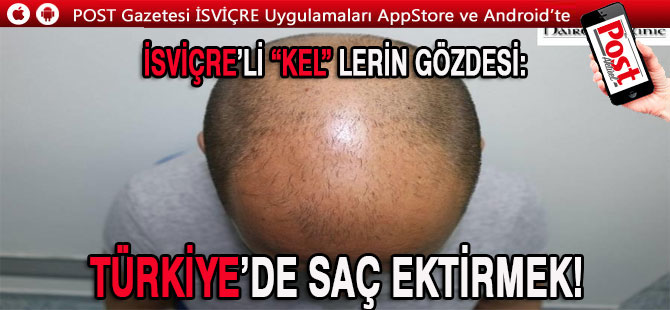 İSVİÇRE’Lİ “KEL”LERİN GÖZDESİ: TÜRKİYE’DE SAÇ EKTİRMEK!