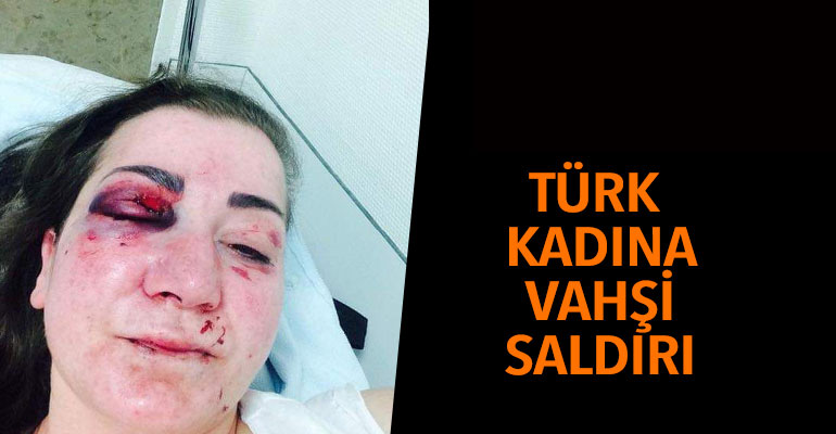 Türk kadına vahşi saldırı