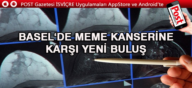 Basel’de Meme kanseri metastazına  karşı yeni bir buluş